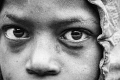 Eyes